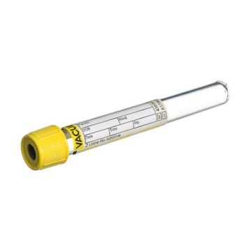 6.5 mL Vacuette Z Urine No Additive Urinalysis Tube - 456007
