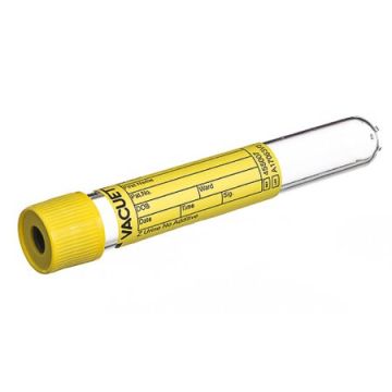 Vacuette Z Urine No Additive Urinalysis Tube, 10 mL - 455007