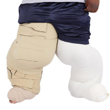 Circaid Lobe Reduction Kit Lymphedema Wrap