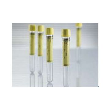 Vacuette Z Urine No Additive Urinalysis Tube, 6.5 mL - 456007