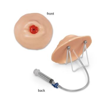 Nasco Life Form Retracted Ostomy Care Training Model (LF00903)
