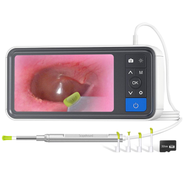 ScopeAround Digital Smart Otoscope with Screen