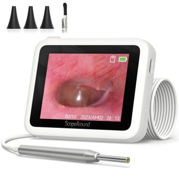 ScopeAround All-In-One 2.8-Inch LCD Screen Digital Otoscope