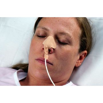 Dale Nasogastric Tube Holder
