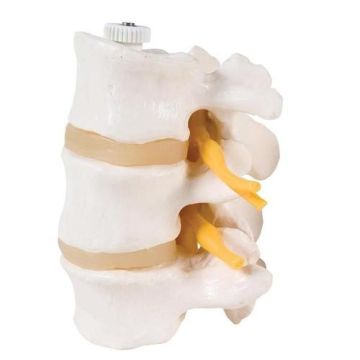 3B Scientific 3 Lumbar Vertebrae, Flexibly Mounted