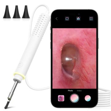ScopeAround USB Otoscope Ear Cleaning Kit