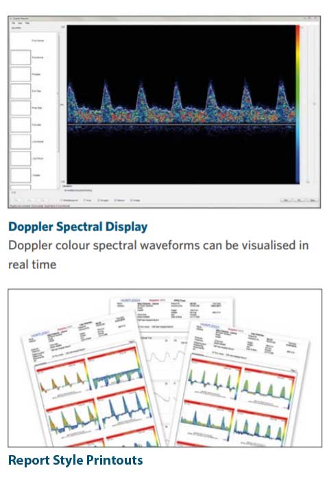 Diagnostic Scan Displays and Reports