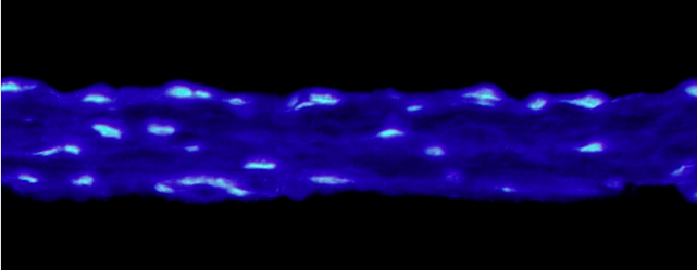 Wound Model at 5 days