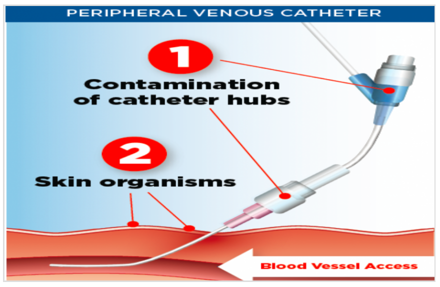 BIOPATCH Antimicrobial Dressing 4150, 4151, 4152 Vitality Medical
