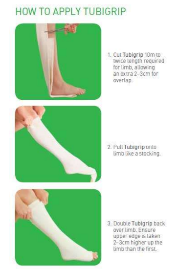 tubigrip tubular molnlycke elasticated gauze wound bandages