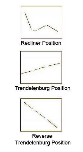 Full and Reverse Trendelenburg