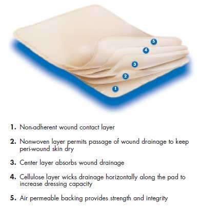 SofSorb Absorbent Wound Dressing