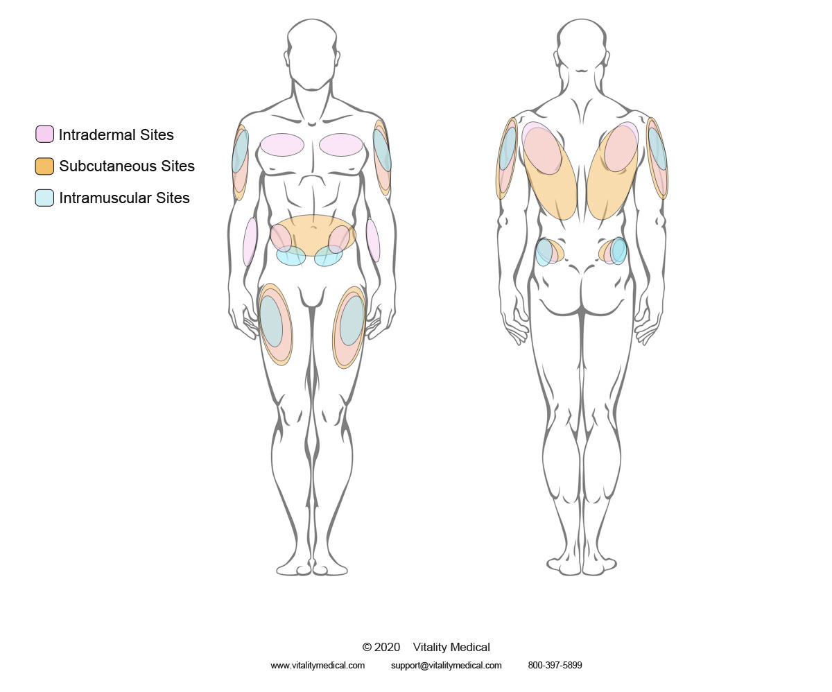 Injection Sites