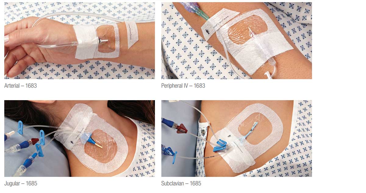 Tegaderm IV Advanced Applications