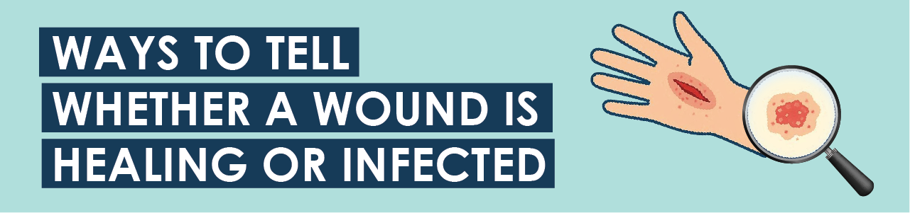 Ways To Tell Whether a Wound Is Healing or Infected