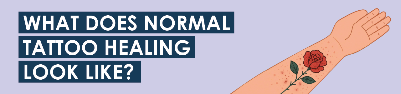 What Does Normal Tattoo Healing Look Like?