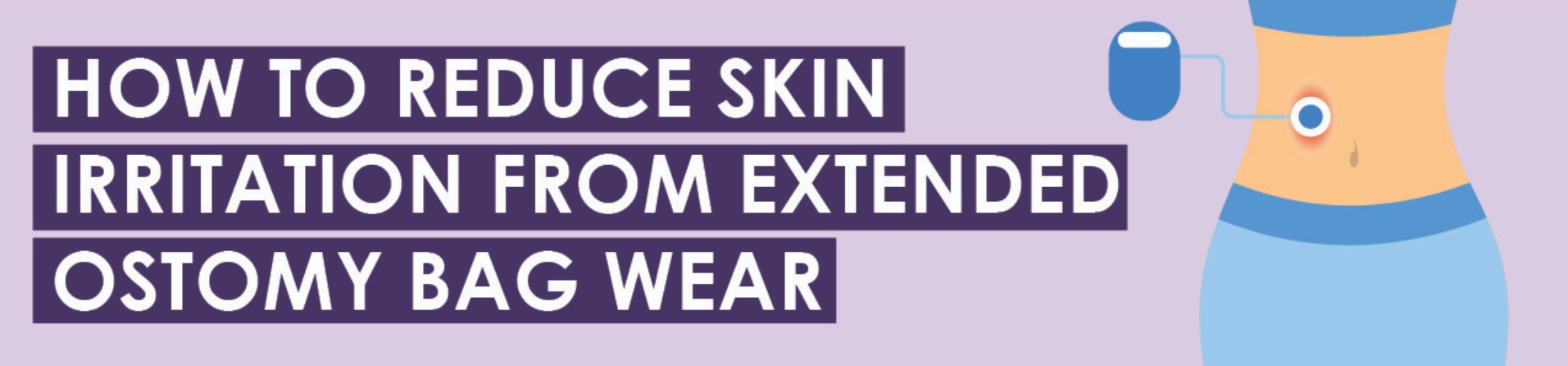 How to Reduce Skin Irritation from Extended Ostomy Bag Wear