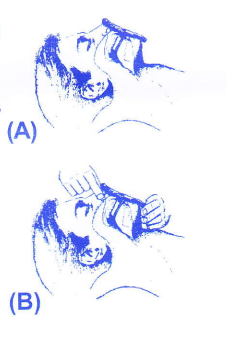 Microshield Instructions