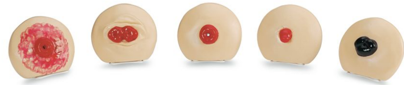 Ostomy Care Simulator and Accessories