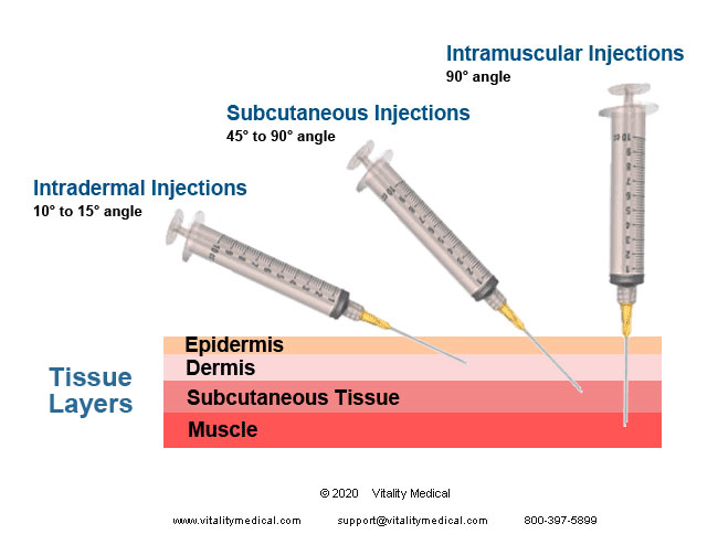 Injection Types