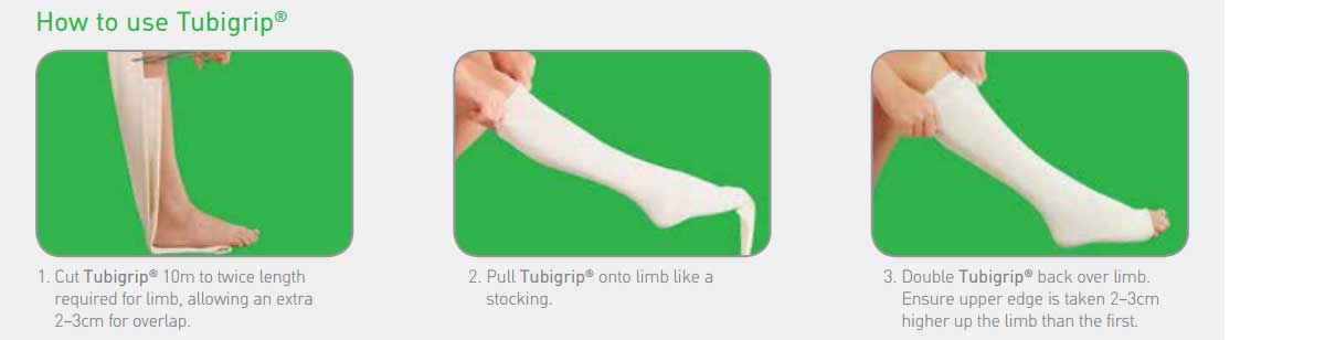 Tubigrip Elasticated Tubular Bandage - Molnlycke Healthcare Size Chart ...