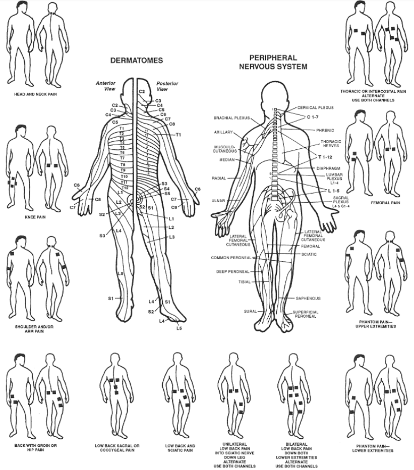 Electrode Placement Chart