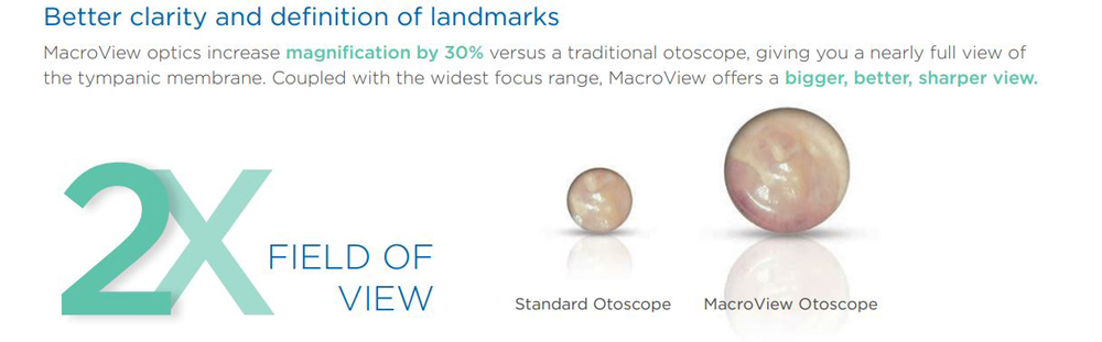 Macroview Otoscope