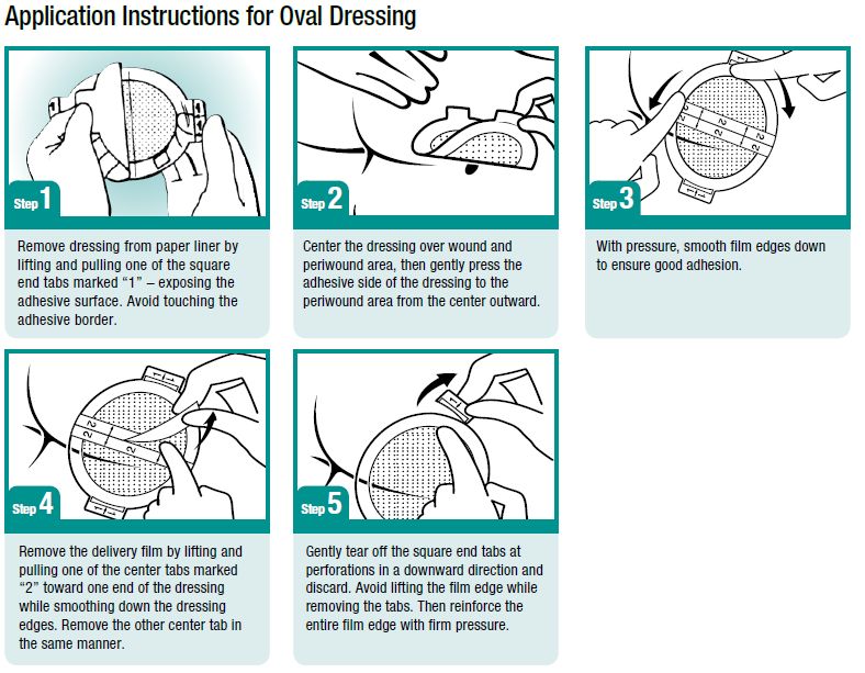 Hydrocolloid Dressing Easy Application