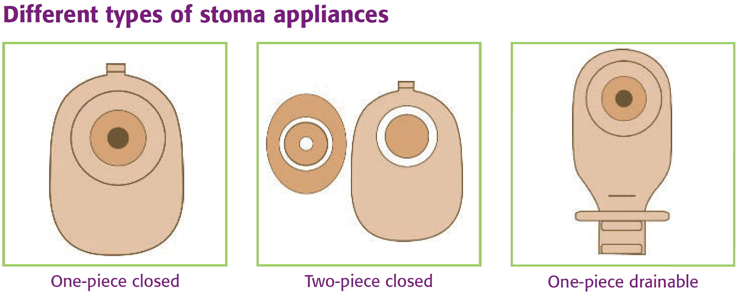 Stoma bag Royalty Free Vector Image - VectorStock