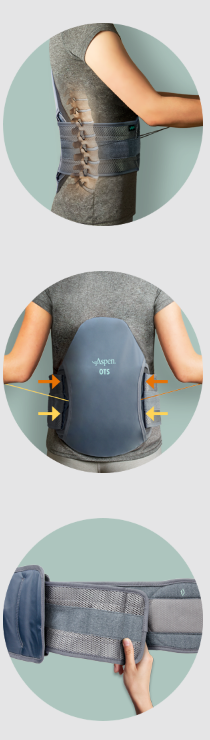 Aspen OTS 650 Lumbar Brace Benefits