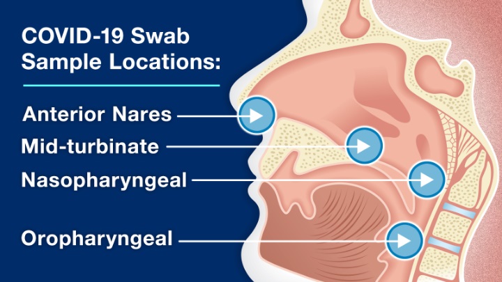 Diagram of possible COVID-19 collection sample locations.