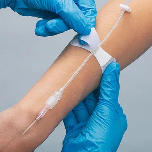 Grip-Lok Catheter Device