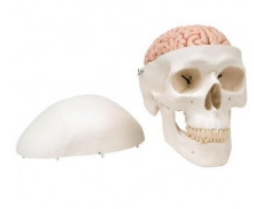 3B Human Skull with Brain