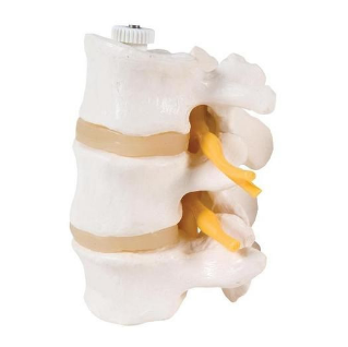 Lumbar Vertebrae Model