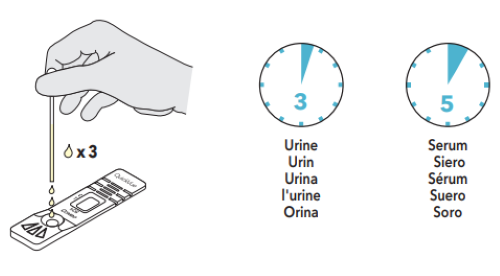 Urine or serum testing illustration