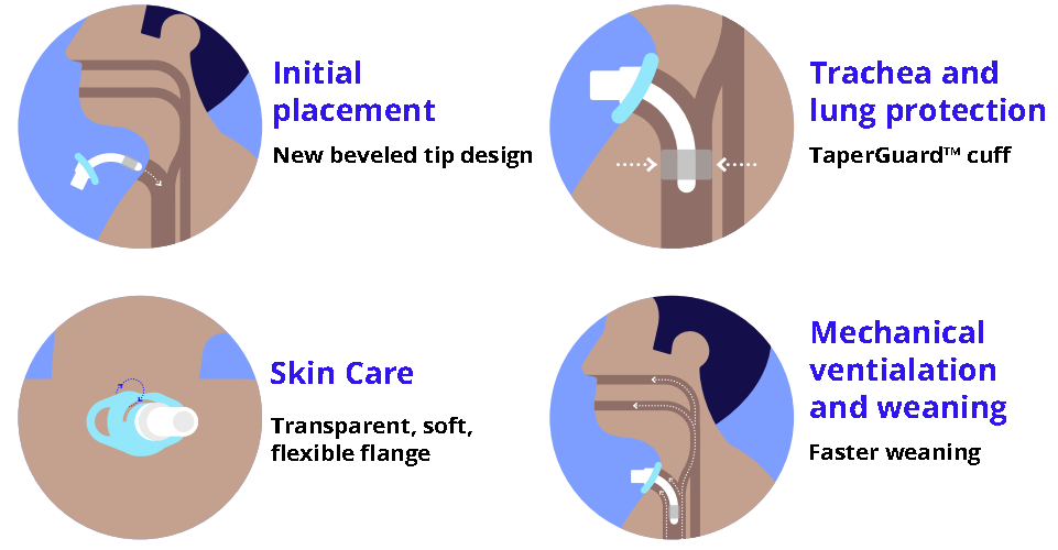 Shiley Flexible Trach Tube Features