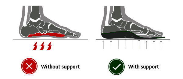 Diagram of arch support versus no arch support