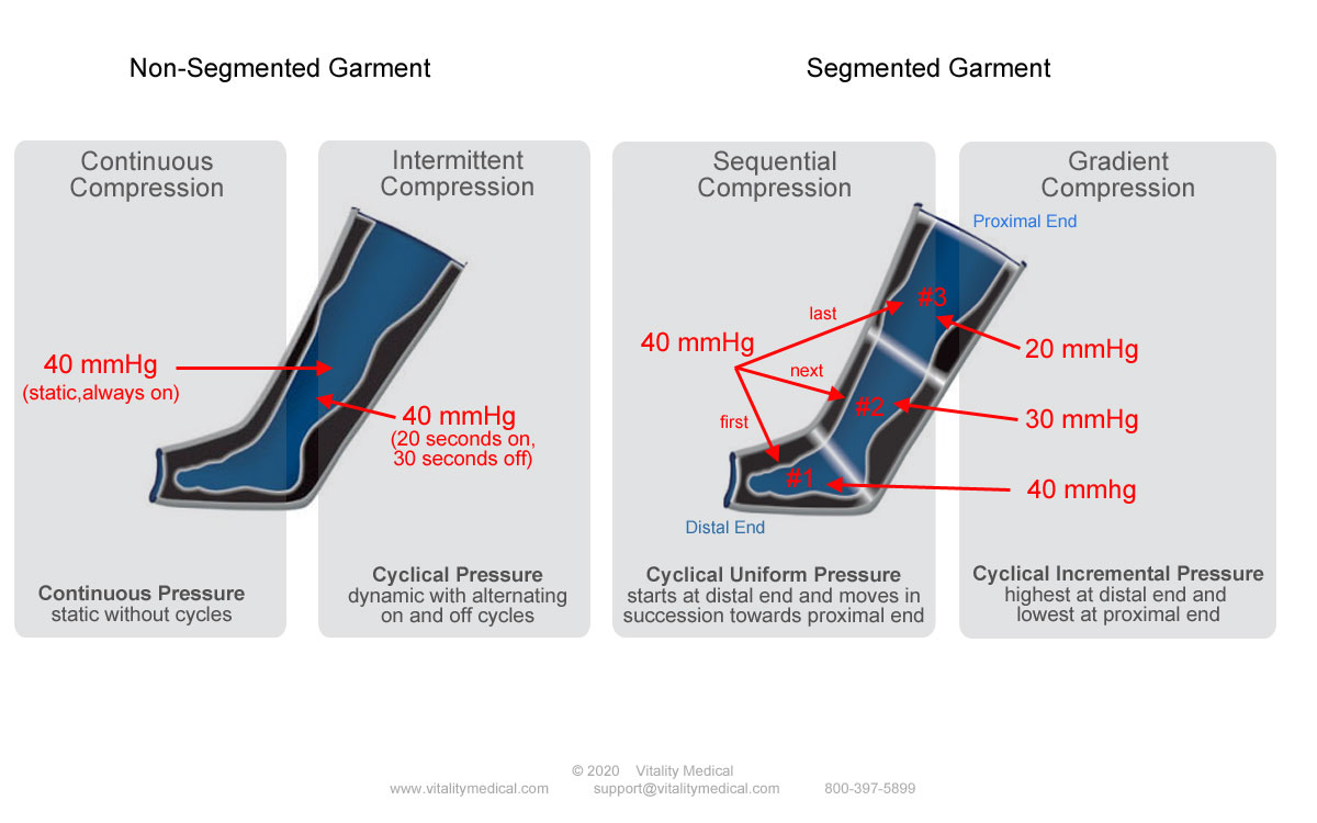 Compression Therapy Options - Continuous, Intermittent, Sequential, Gradient