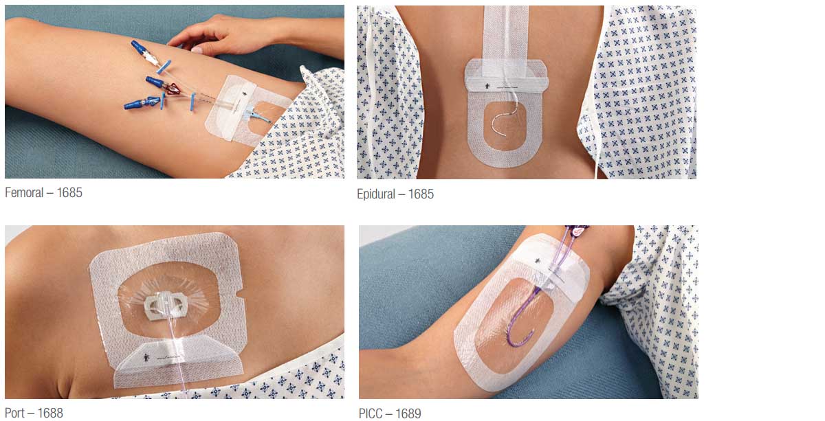 3M Tegaderm IV Advanced Securement Dressings Vitality Medical